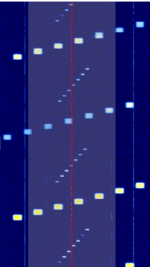 T2 mri cropped.png